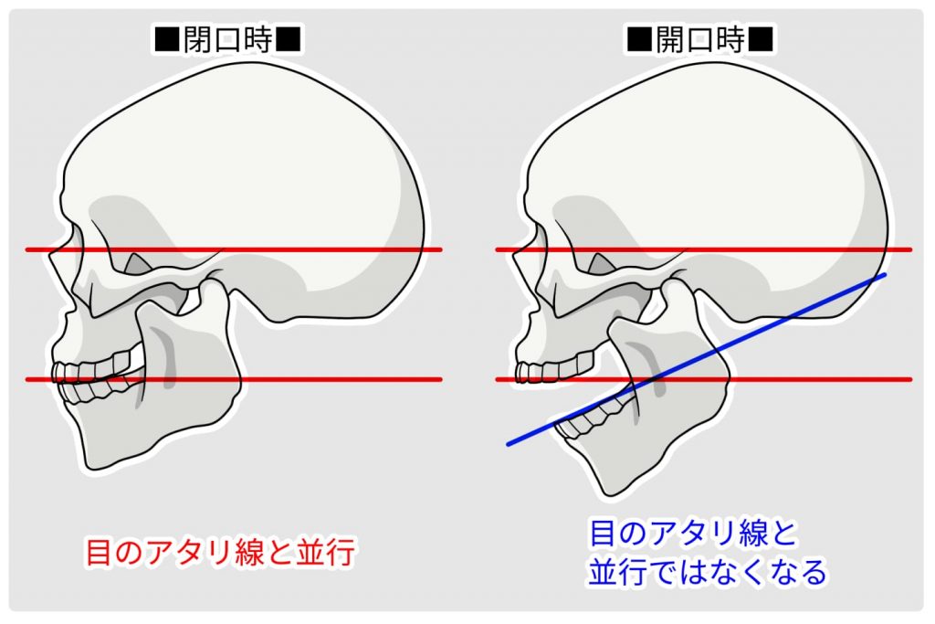 歯とあごの関係の図解イラスト