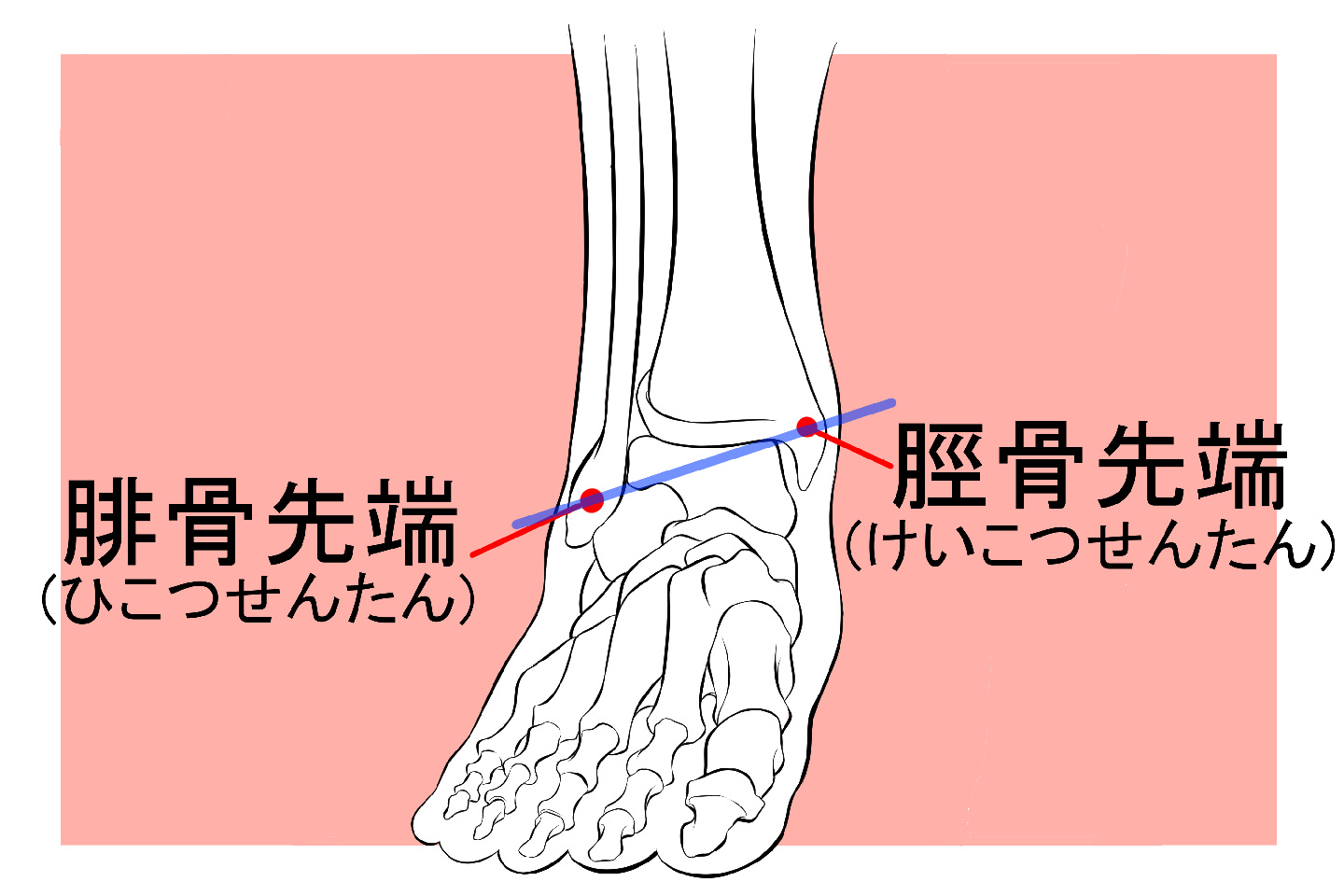 腓骨先端と脛骨先端のイラスト図解