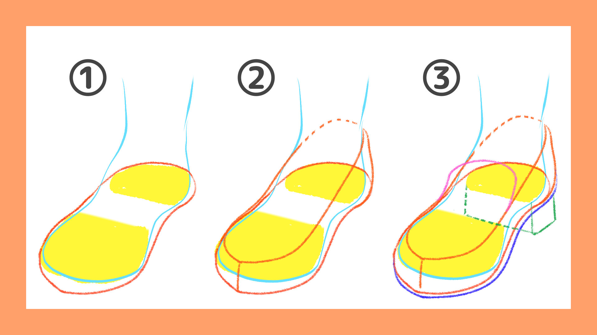 足と靴のアタリ