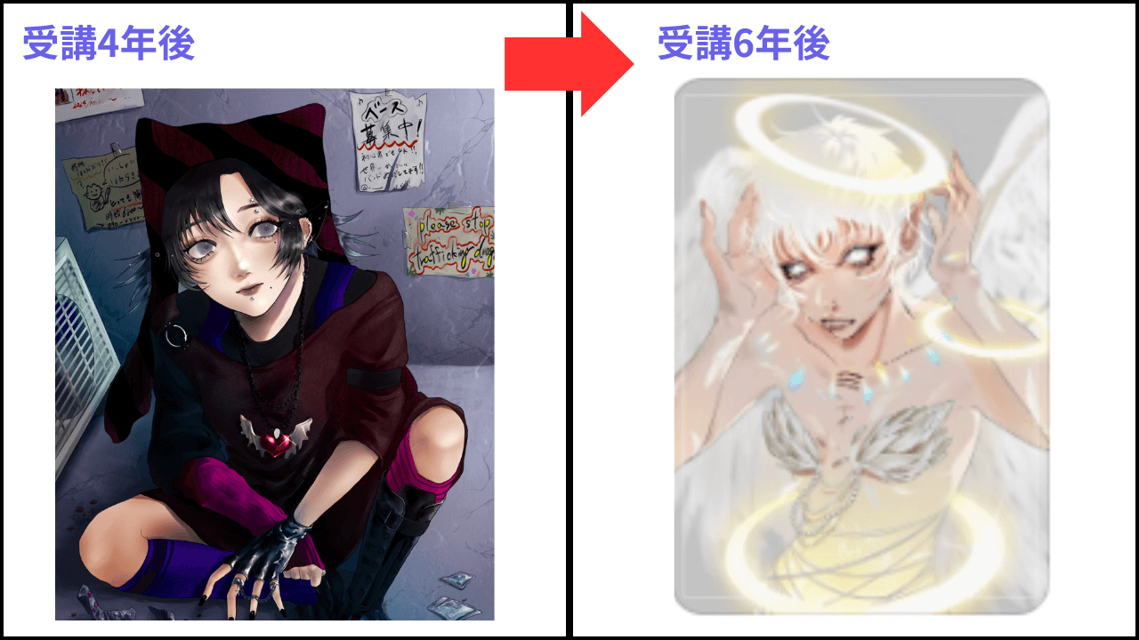 Uさんのビフォーアフター