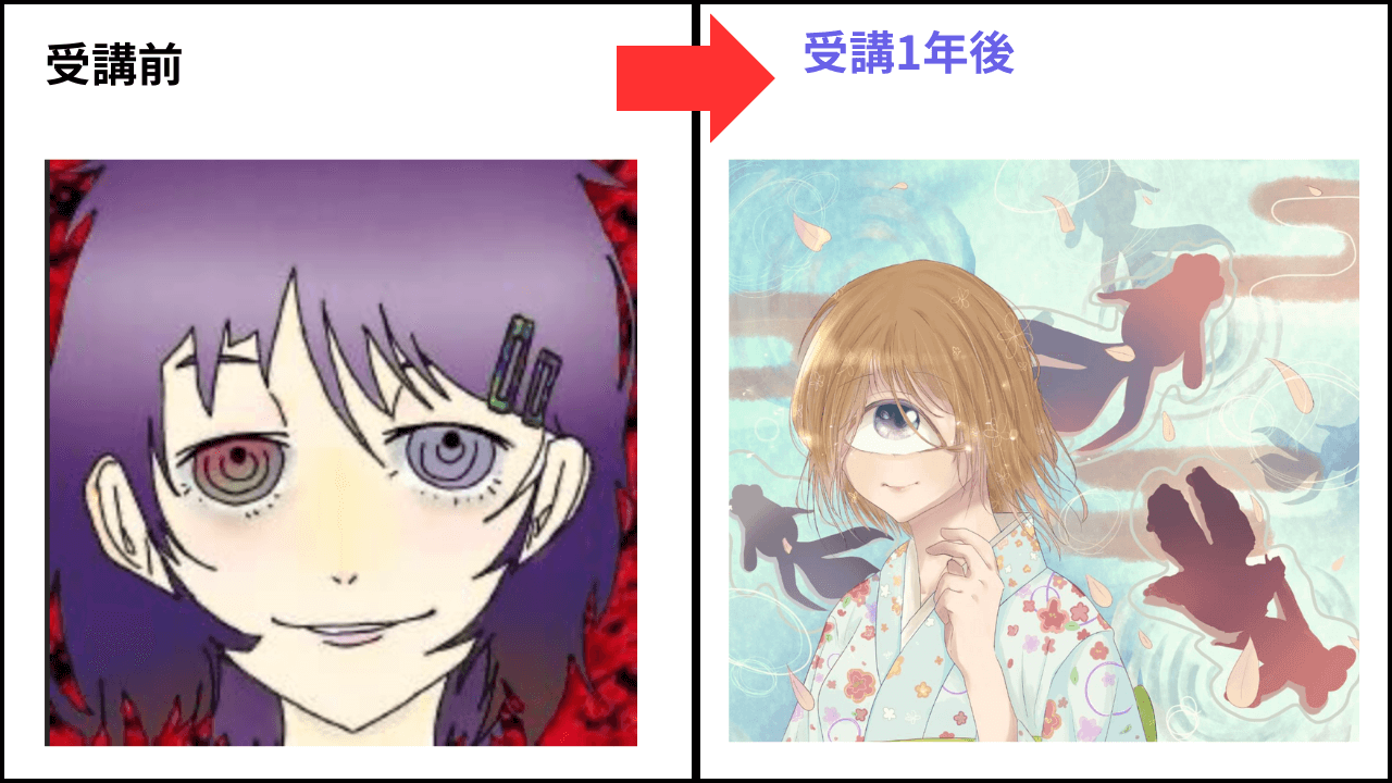 Uさんのビフォーアフター