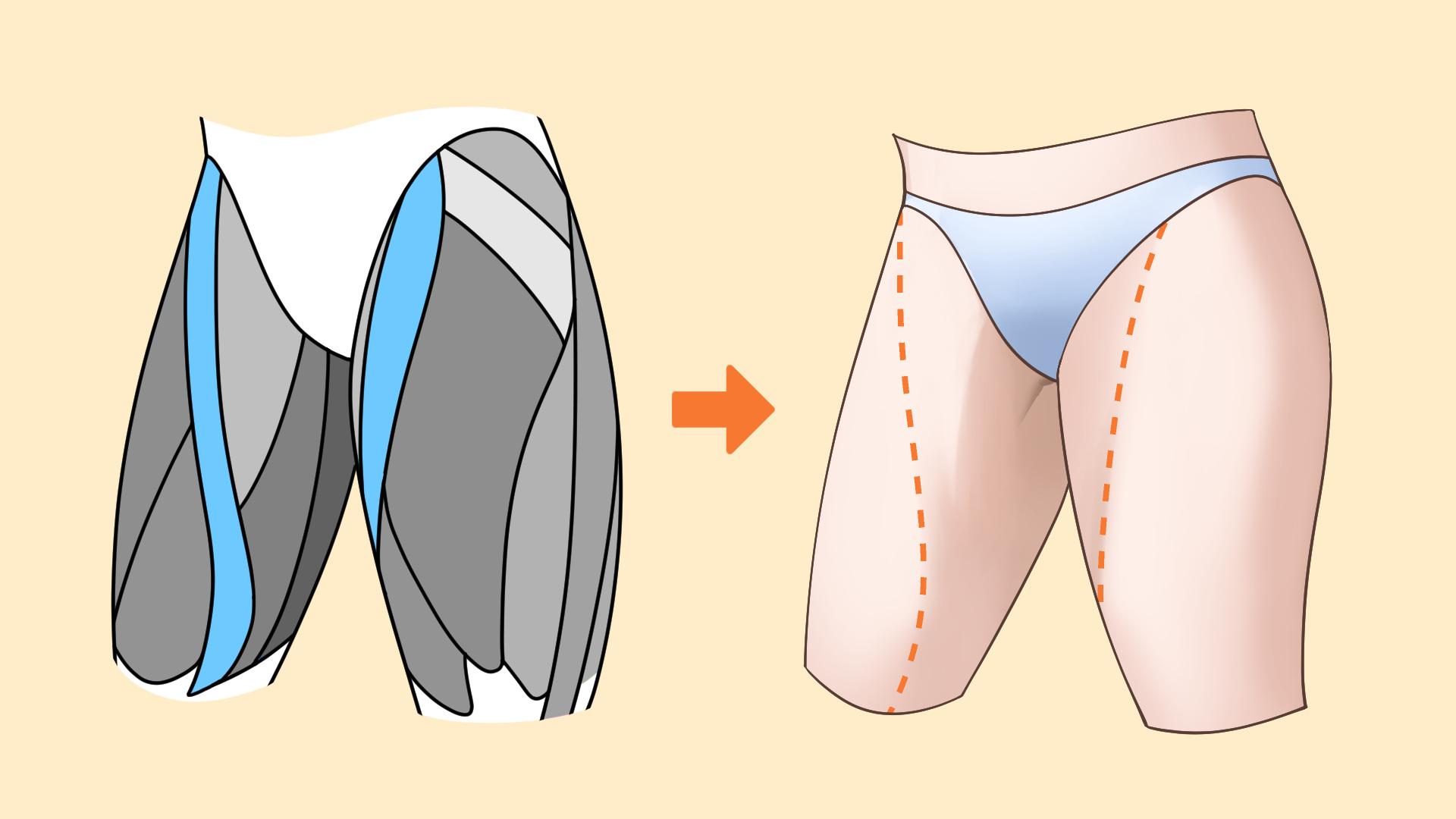 縫工筋（手順画像 5）